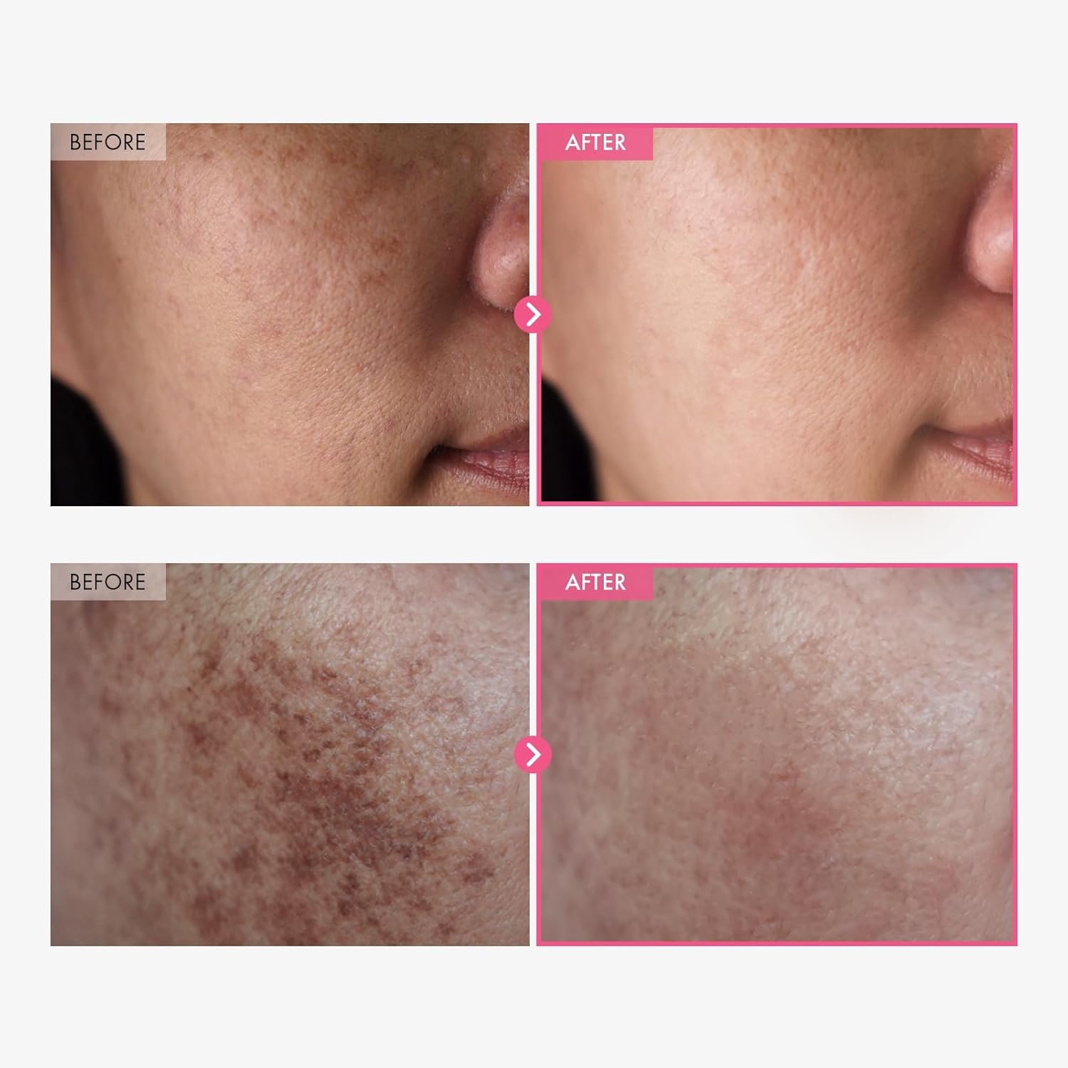 TOSOWOONG Dark Spots, Freckle, Blemishes, Pigmentation, Korean Skin Care, 50ml, - Image 2